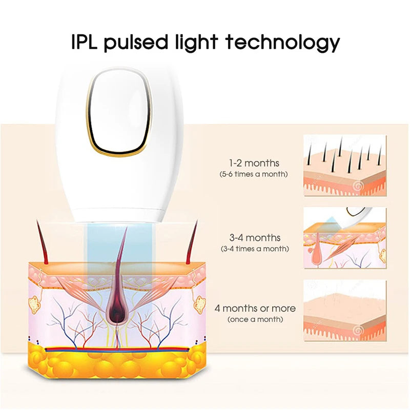 IPL Laser Hair Removal Epilator – 999900 Flashes